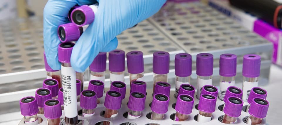 Фото новости: "В лабораториях заканчиваются самые популярные тесты на аллергию"